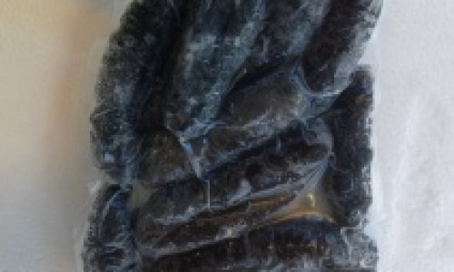 权威手上脚上起小红点是什么原因平台,分享专业手上脚上起小水泡很痒用什么药知识_脚上手上身上长块状硬东西网